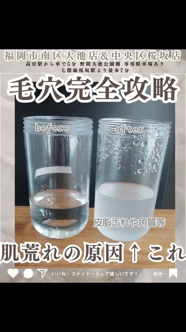 【月1のサブスク会員様の施術後👆️しっかり取れてます😱】